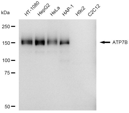 ATP7B Antibody in Western Blot (WB)