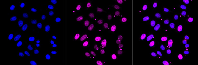 KIF23 Antibody in Immunocytochemistry (ICC/IF)