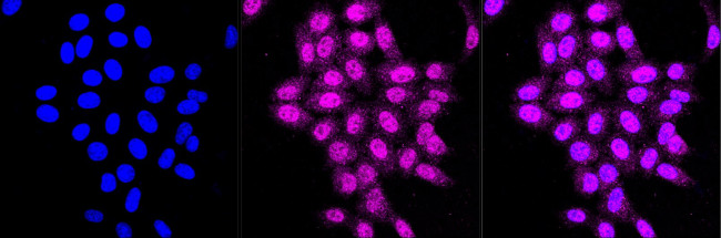 RANBP9 Antibody in Immunocytochemistry (ICC/IF)