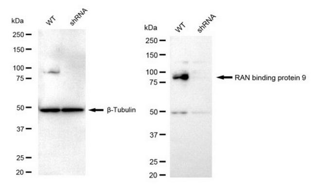 RANBP9 Antibody