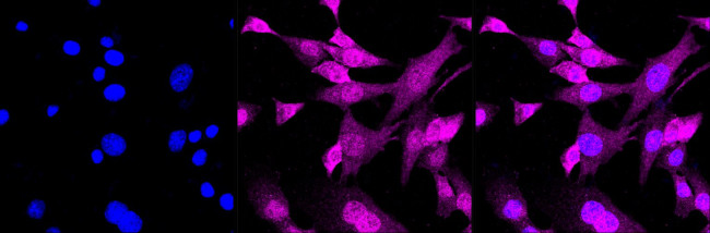 Phospho-SMAD2 (Ser250) Antibody in Immunocytochemistry (ICC/IF)