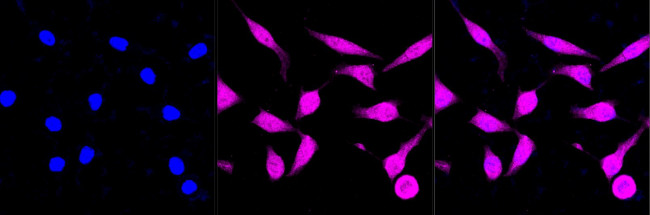 STAT1 Antibody in Immunocytochemistry (ICC/IF)