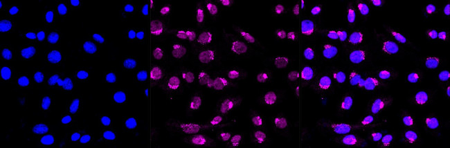 VPS35 Antibody in Immunocytochemistry (ICC/IF)