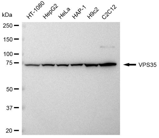 VPS35 Antibody in Western Blot (WB)