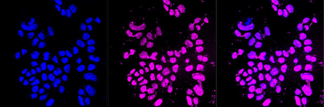 H3K9ac Antibody in Immunocytochemistry (ICC/IF)