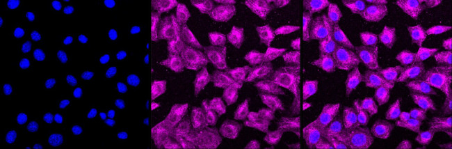 ERK1/ERK2 Antibody in Immunocytochemistry (ICC/IF)