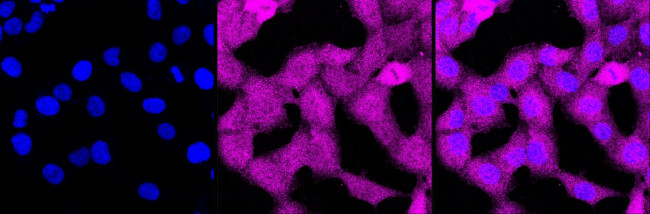 p38 MAPK Antibody in Immunocytochemistry (ICC/IF)