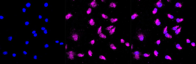 TDP-43 Antibody in Immunocytochemistry (ICC/IF)