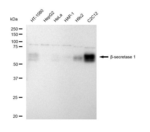 BACE1 Antibody in Western Blot (WB)