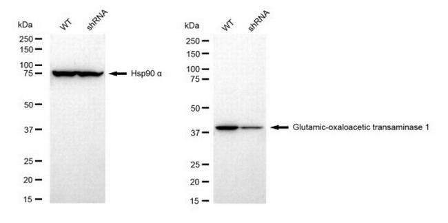 GOT1 Antibody