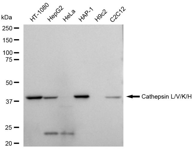 Cathepsin H/K/L/V Antibody in Western Blot (WB)