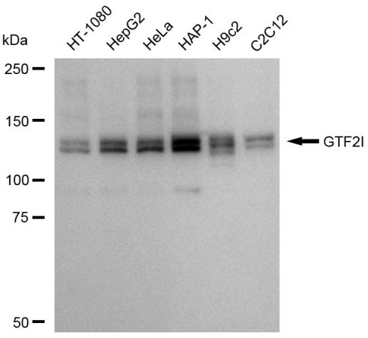 GTF2I Antibody in Western Blot (WB)