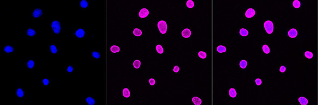 E2F1 Antibody in Immunocytochemistry (ICC/IF)