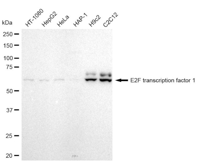 E2F1 Antibody in Western Blot (WB)