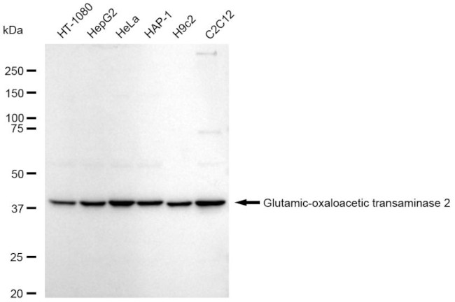 GOT2 Antibody in Western Blot (WB)