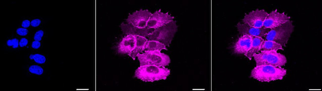 EGFR Antibody in Immunocytochemistry (ICC/IF)