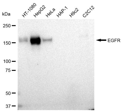 EGFR Antibody in Western Blot (WB)