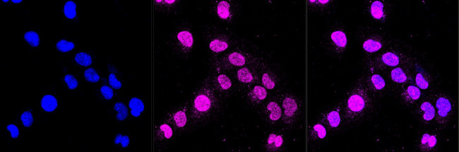 beta Galactosidase Antibody in Immunocytochemistry (ICC/IF)