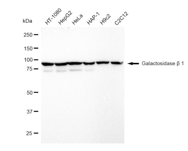 beta Galactosidase Antibody in Western Blot (WB)