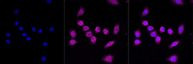 FOXO1 Antibody in Immunocytochemistry (ICC/IF)