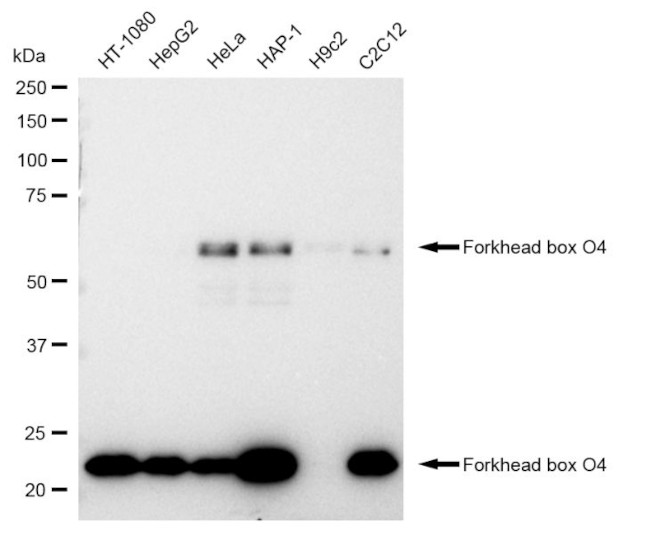 FOXO4 Antibody in Western Blot (WB)