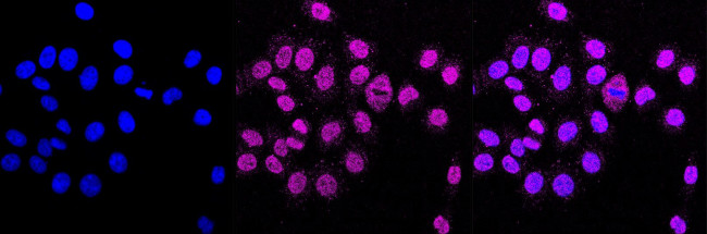 Ferritin Heavy Chain Antibody in Immunocytochemistry (ICC/IF)