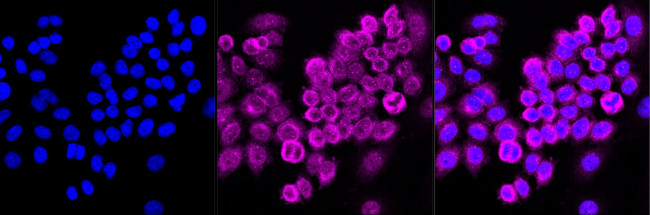 NFkB p65 Antibody in Immunocytochemistry (ICC/IF)