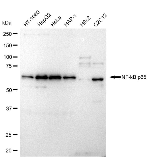 NFkB p65 Antibody in Western Blot (WB)