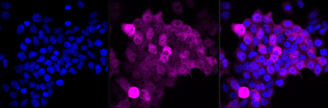 Glutamine Synthetase Antibody in Immunocytochemistry (ICC/IF)