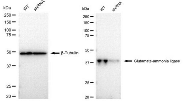 Glutamine Synthetase Antibody