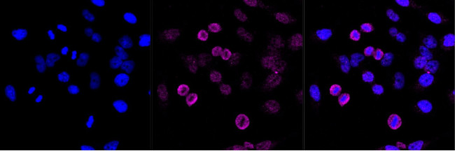 LAMP1 Antibody in Immunocytochemistry (ICC/IF)