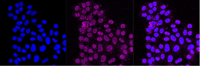 ErbB2 (HER-2) Antibody in Immunocytochemistry (ICC/IF)