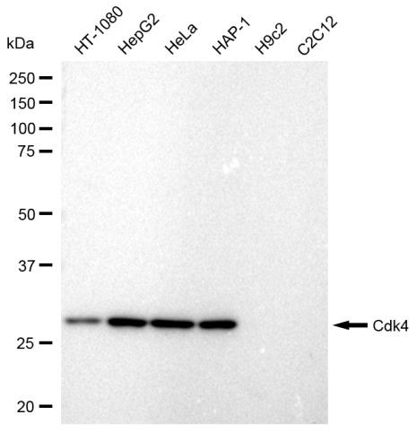 CDK4 Antibody in Western Blot (WB)