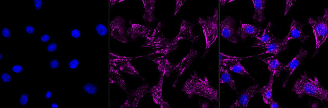 ITGA5 Antibody in Immunocytochemistry (ICC/IF)