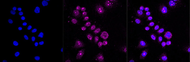 GSK3 alpha/beta Antibody in Immunocytochemistry (ICC/IF)