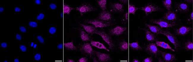 SMAD4 Antibody in Immunocytochemistry (ICC/IF)