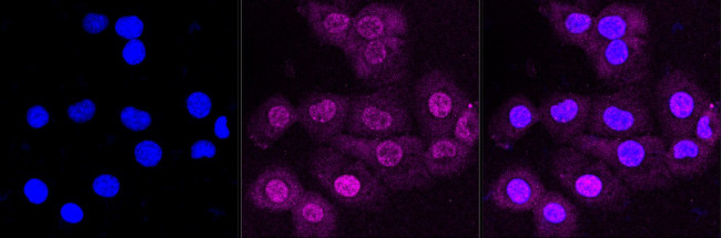 GSK3B Antibody in Immunocytochemistry (ICC/IF)