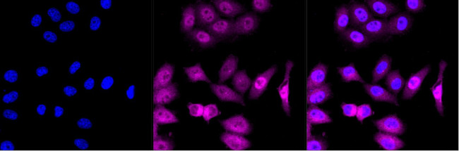 ATP Citrate Lyase Antibody in Immunocytochemistry (ICC/IF)