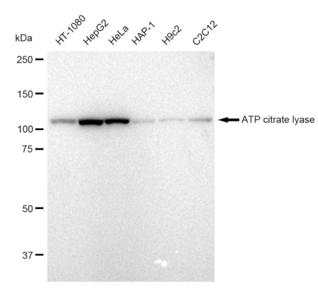 ATP Citrate Lyase Antibody in Western Blot (WB)