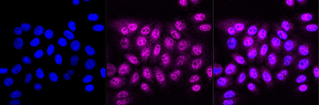 IKK alpha Antibody in Immunocytochemistry (ICC/IF)