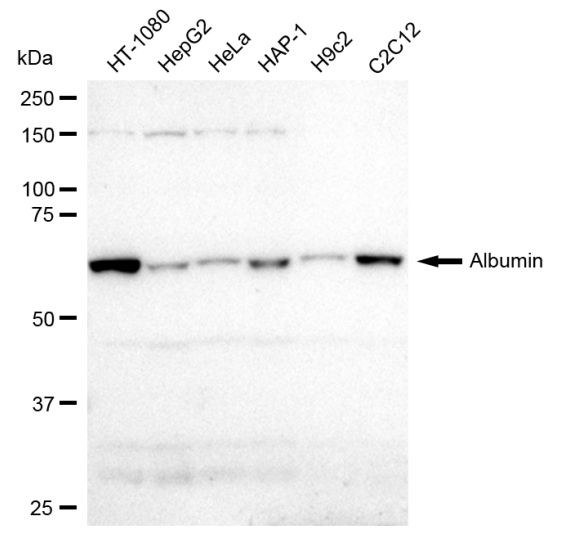 Albumin Antibody in Western Blot (WB)