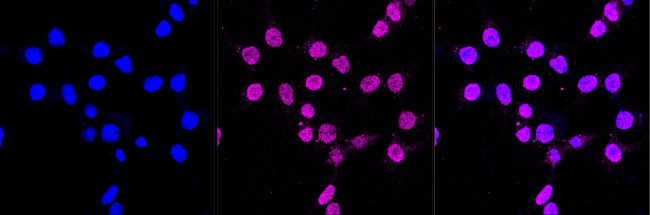 CD163 Antibody in Immunocytochemistry (ICC/IF)