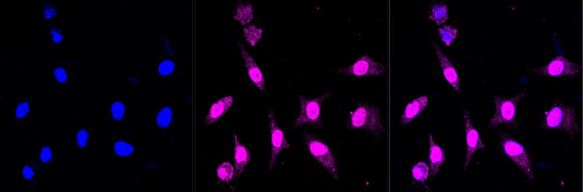 LAMP2 Antibody in Immunocytochemistry (ICC/IF)