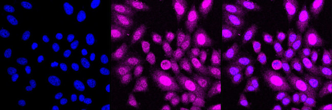 BUBR1 Antibody in Immunocytochemistry (ICC/IF)