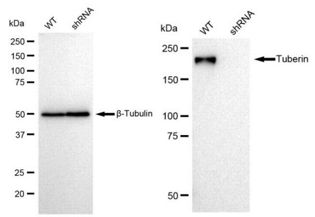 TSC2 Antibody