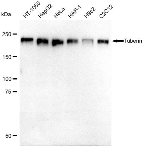 TSC2 Antibody in Western Blot (WB)