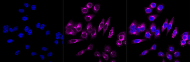 Phospho-GSK3B (Ser9) Antibody in Immunocytochemistry (ICC/IF)