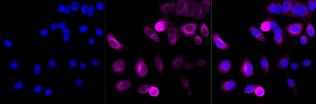 Cyclin B1 Antibody in Immunocytochemistry (ICC/IF)