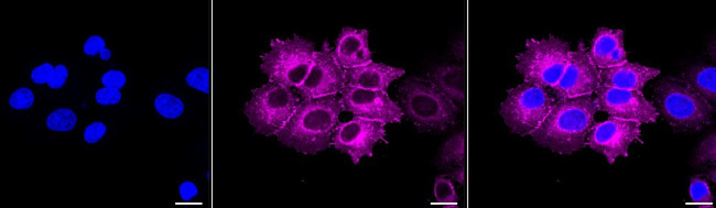 EGFR Antibody in Immunocytochemistry (ICC/IF)