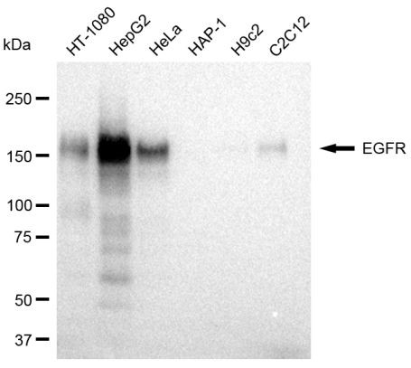 EGFR Antibody in Western Blot (WB)